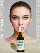 ANTI ACNE DEAL